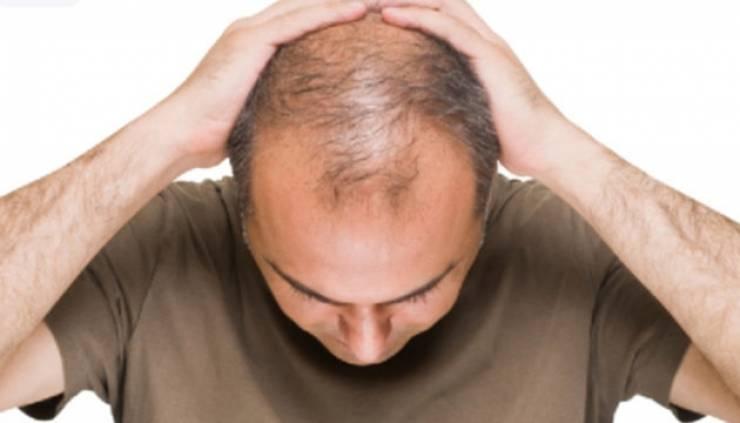 بعد 73 عاما خبرة.. حلاق ايطالي يكشف أغرب طريقة لوقف تساقط الشعر