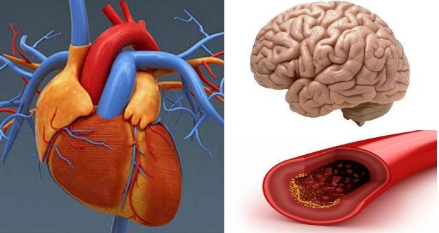 أنقذوا الكلى والقلب والدماغ: نظفوا شرايينكم بواسطة 3 مكونات فقط
