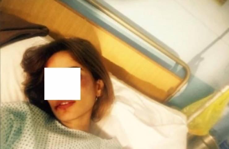 فيديو| هذه الفنانة الشهيرة تعرضت للضرب المبرح على يد زوجها!