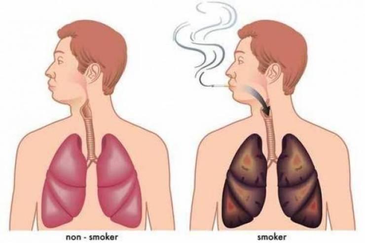 أفضل مشروب طبيعي يطهّر الرئتين من آثار التدخين!