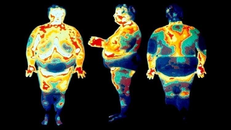 دراسة: الميكروبات قد تكون السبب في السمنة