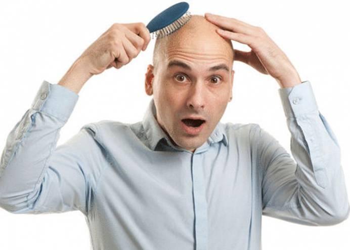 للرجال فقط.. 12 سبباً لتساقط الشعر