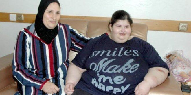 طفلــة وزنها 200 كيـلوغـرام
