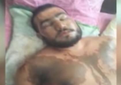 هكذا انتقمت سوريّة من زوجها بعد أن أجبرها على الدعارة ونقل لها الإيدز