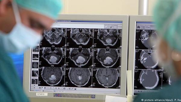 تضاعف عدد الإصابات بالسرطان في ألمانيا منذ عام 1970