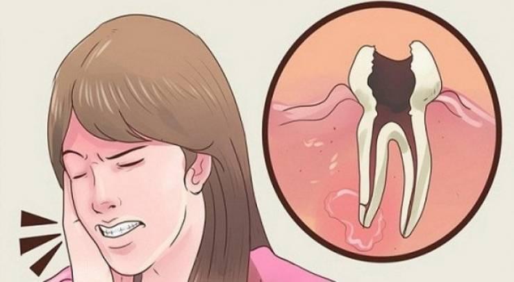 إليكم هذه الوصفة المعجزة لتخفيف ألم الأسنان في ثوانٍ!!
