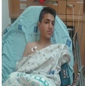 رصاص الاحتلال العشوائي يصيب فتى بكسور ونزيف بالجمجمة