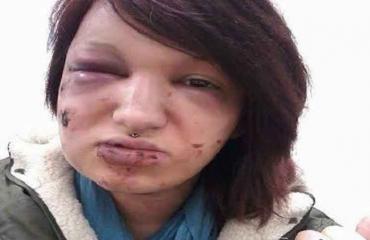 عضّها 21 مرّة حتّى لا ينظر إليها أيّ رجلٍ آخر