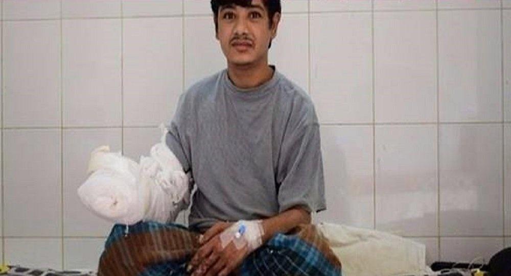 بالصور.. بعد 16 عمليّة جراحيّة..