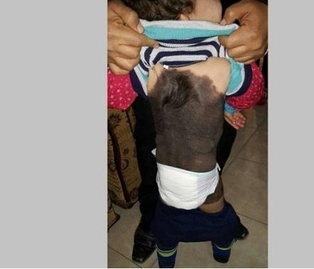 الرئيس ووزير الصحة يتبنيان علاج طفل 