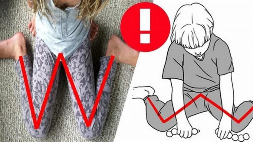 ما هي الآثار الناتجة عن جلوس الطفل بوضعية W؟
