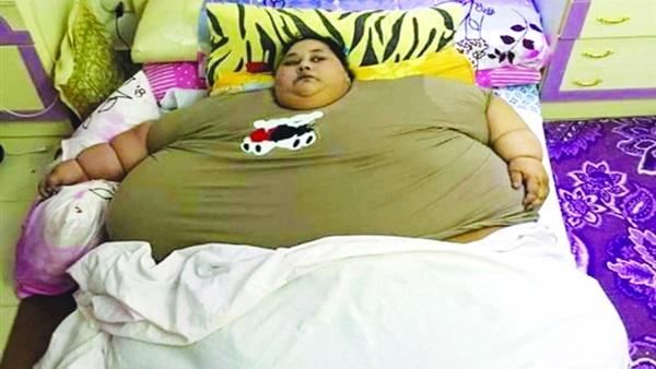 صور- صدمة للمصرية التي تزن نصف طن عقب وصولها الهند للعلاج