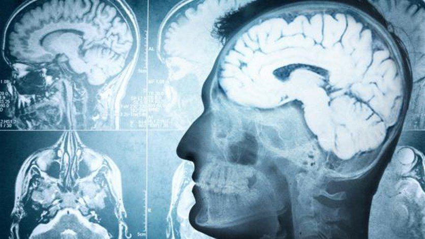 إصابات الرأس تتسبب بأضرار خطيرة للدماغ!