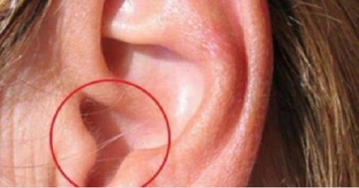 هل لديك شعر على أذنك؟