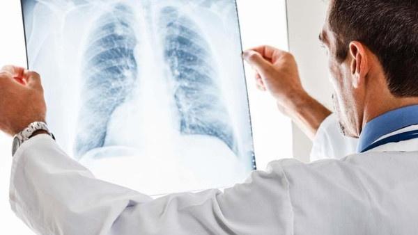 تطوير تقنية لفحص الرئة تقلل من استخدام المضادات الحيوية