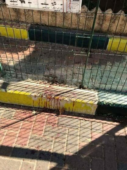 بعد إصابة طالب- تعليق الرحلات المدرسية لحديقة حيوانات قلقيلية وتشكيل لجنة تحقيق