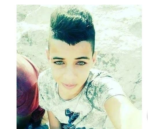 استشهاد فتى من الجلزون متأثراً بجراحه