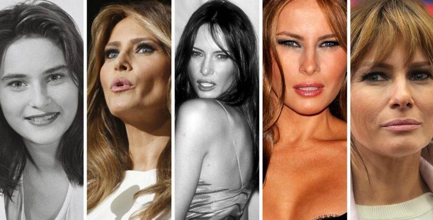 بالصور - الكشف عن عدد عمليات التجميل التي أجرتها ميلانيا ترامب.. وكلفتها خيالية!
