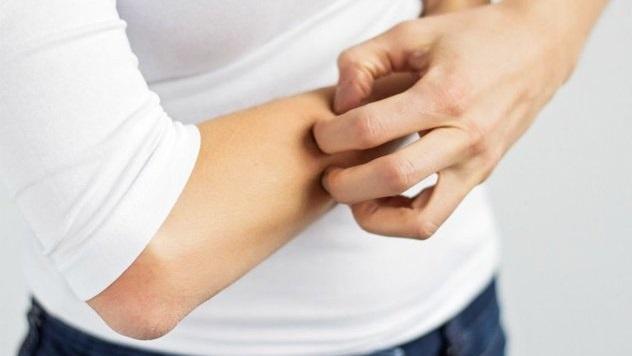 لماذا نشعر بالراحة عندما نحك أجسادنا؟