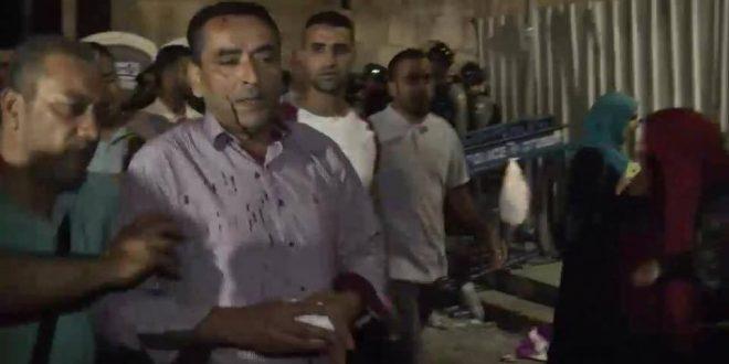 إصابات في اعتداءات على المصلين قرب باب الأسباط