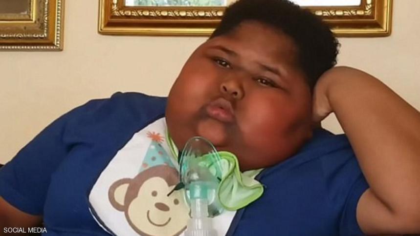طفل يعاني شهية