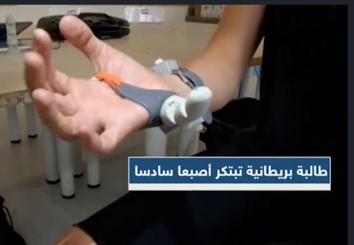 ابتكار نموذج لأصبع سادس في يد الإنسان