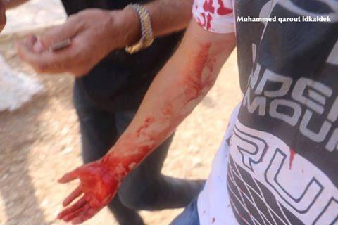 عشرات الإصابات وقرار بتقييد الدخول للأقصى