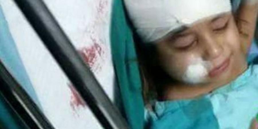 إصابة طفلة بجروح بالغة نتيجة سقوطها عن احدى ألعاب الملاهي في جنين