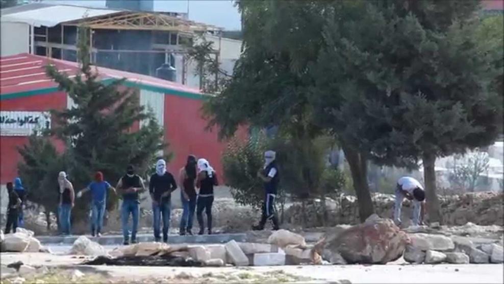 الاحتلال يصيب شابا بعيار مطاطي جنوب بيت لحم