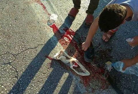 اصابة حرجة لمواطن اثر حادث دهس على مفرق مسجح شرق بيت لحم