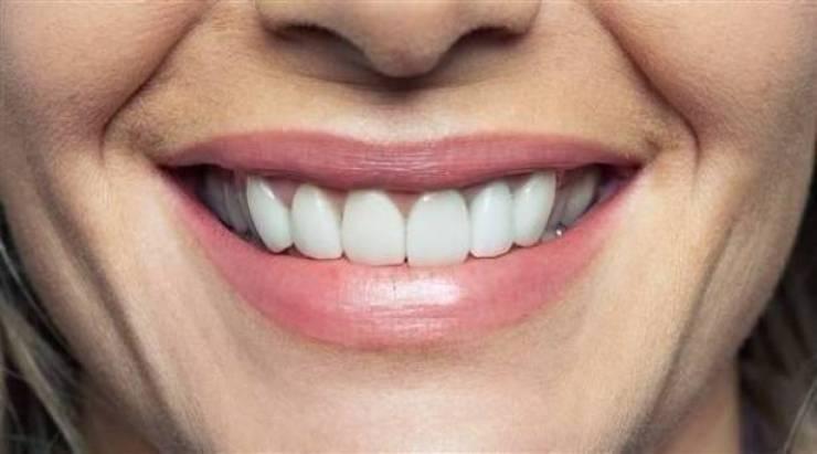 لا تتلف أسنانك بهذه الأخطاء البسيطة!