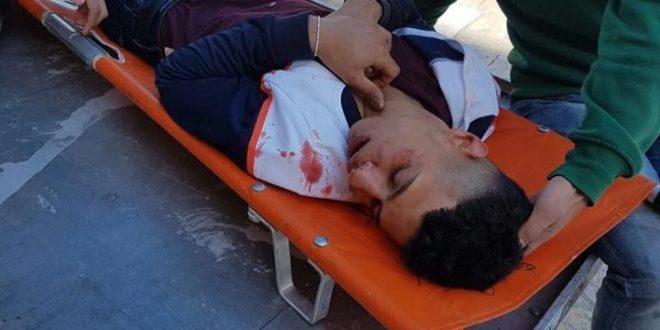 محدث : مستوطنون ينهالون بالضرب المبرح على مقدسي