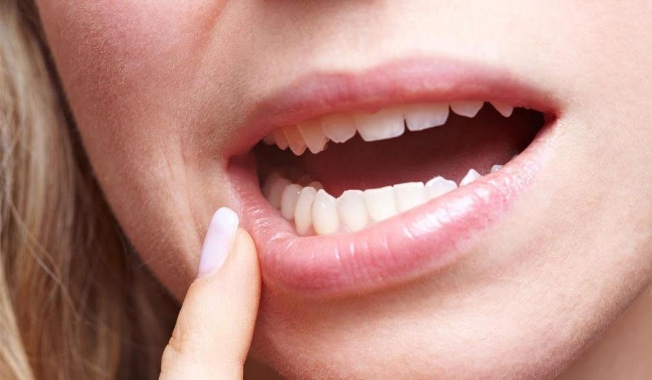 المصابون بالسكري أكثر عرضة لمضاعفات أمراض الفم والأسنان