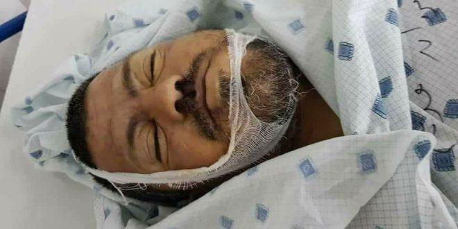 شهيد متأثر ابإصابته بمسيرة العودة وقصف مواقع للمقاومة بغزة