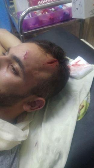 مستوطنون يفتكون بفلسطينيين قرب حاجز عسكري