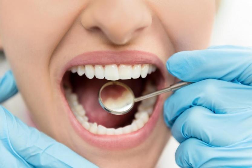 5 علاجات من مطبخك تخفف آلام الأسنان
