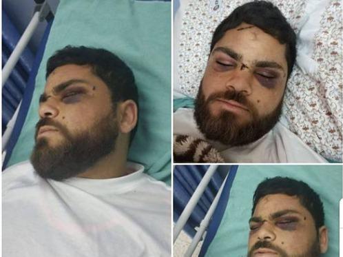 الإفراج عن الأسير السلايمة وأثار التعذيب ظاهرة عليه 