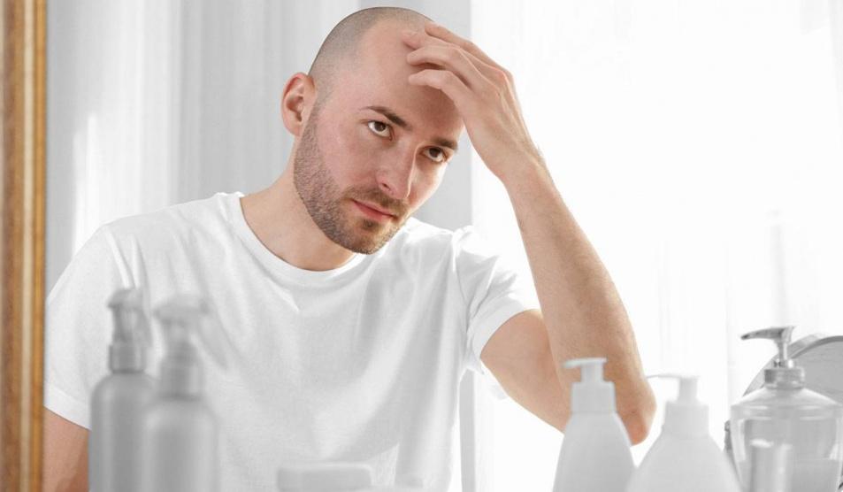 العمل ساعات طويلة يسرع إصابتك بالصلع