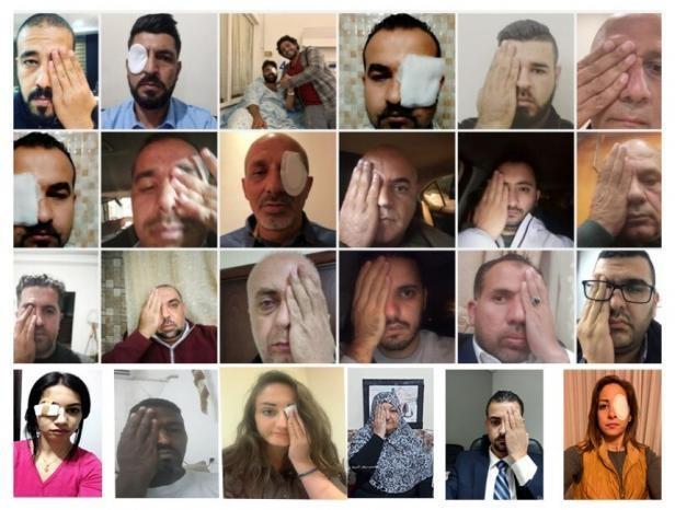 اطلاق حملة إلكترونية تضامنا مع الزميل معاذ عمارنة وتنديدا بانتهاكات الاحتلال ضد الصحفيين