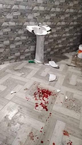 إصابة طفل بسقوط نافذة بفعل الرياح غرب سلفيت