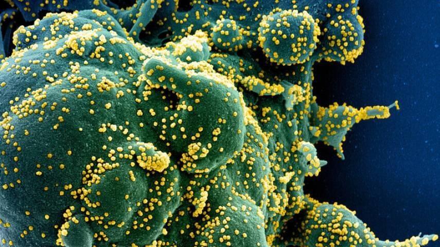 علماء صينيون: تعايشوا مع كورونا لاستحالة القضاء عليه نهائيًا