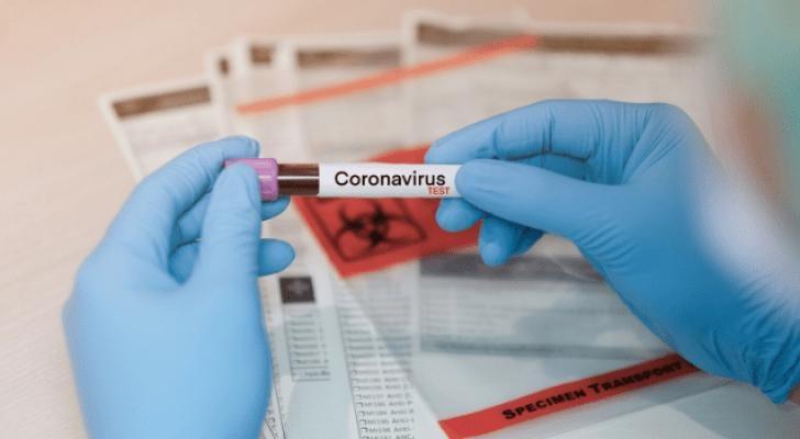 النجار: 10000 عينة يتم سحبها يومياً والمسحات تكفينا لـ20 يوماً