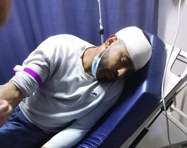 إصابة عامل بقنبلة غاز برأسه خلال توجهه الى العمل في الداخل المحتل