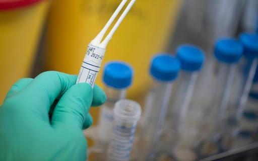 وفاتان و97 إصابة جديدة بفيروس 