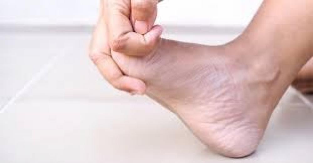 7 أمراض تسبب ألما في إصبع القدم الكبير