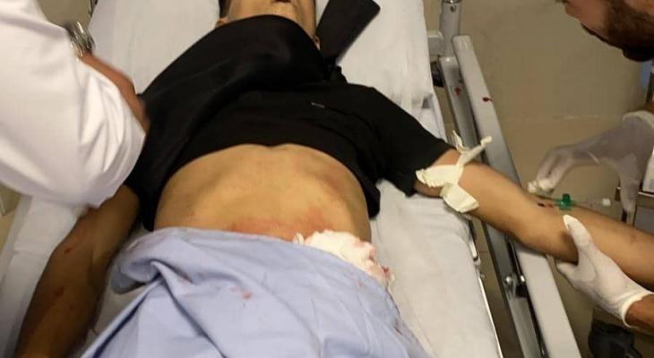 شهيدان وإصابات خلال مواجهات في جنين