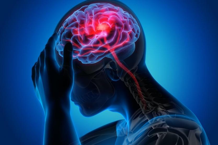 يجب ألا تتجاهلها.. علامات تدل على الإصابة بسكتة دماغية صغيرة