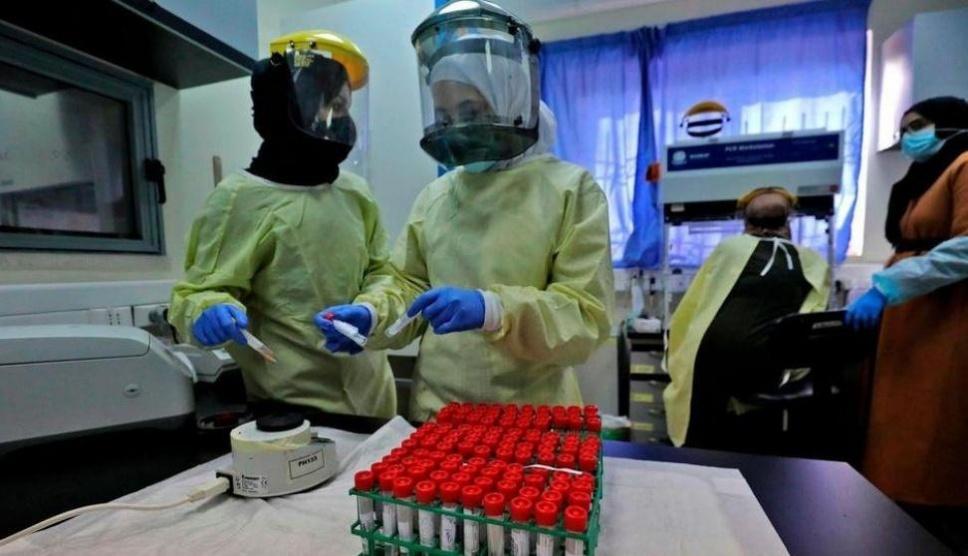 الصحة: لا وفيات و403 إصابات جديدة بكورونا و224 حالة تعافٍ خلال أسبوع