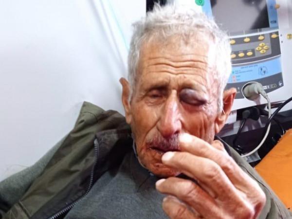 إصابة مسن بكسور ورضوض جراء اعتداء مستوطنين عليه شرق طولكرم