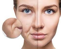 تجاعيد الابتسامة.. ما هي وكيف تتخلصون منها؟